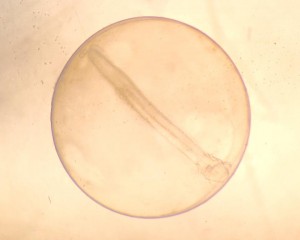 Halibut embryo