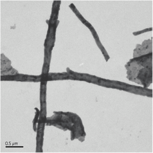 EML TEM Photo