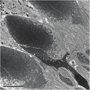 EML TEM Photo