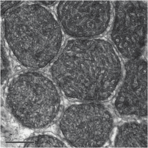 EML TEM Photo