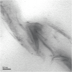 EML TEM Photo