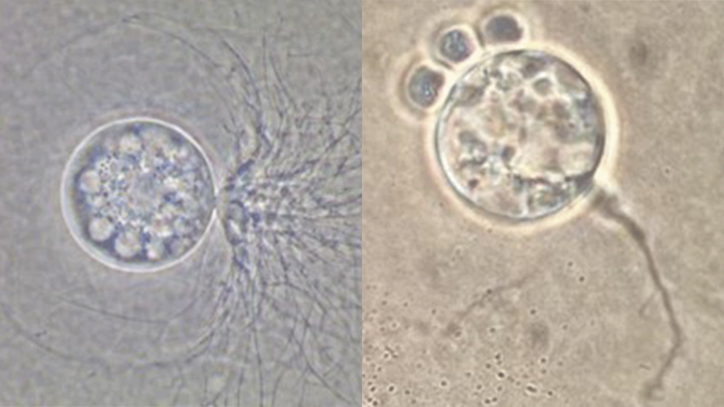 Two microscopic images of a chytrid and thraustochytrid