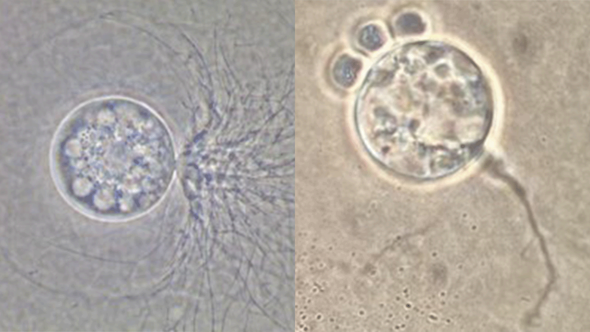 Two microscopic images of a chytrid and thraustochytrid
