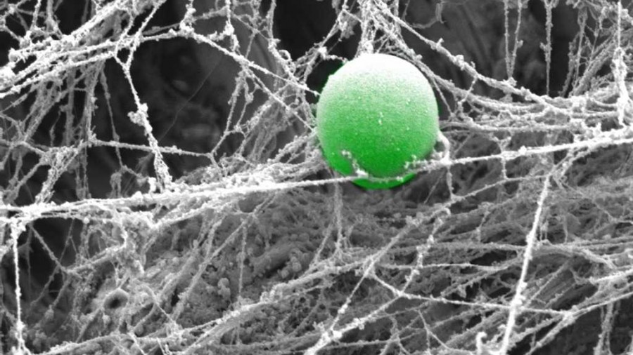 A S. aureus cell in a fibrous network