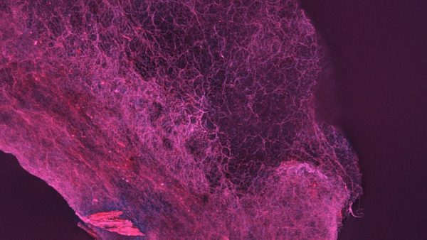 A microscope image of mycelium