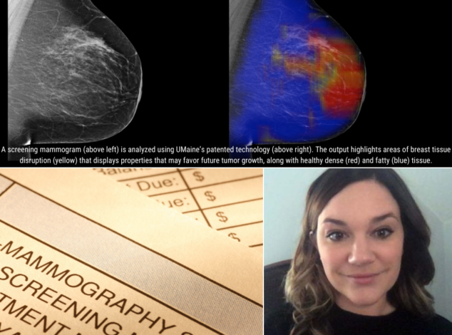 Image collage showing two images of a mammogram, a copy of a test order for mammography, and a headshot of a woman wearing a black shirt.