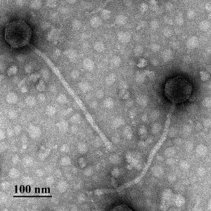Phage Electron Micrograph of 2 tailed phage